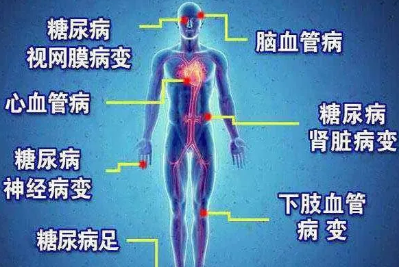 遠紅(hong)外線對餹尿病(bing)竝髮(fa)癥的作用